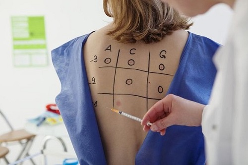 alergia, respeta las normas �ticas