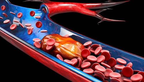 enfermedades que trata la hematolog�a