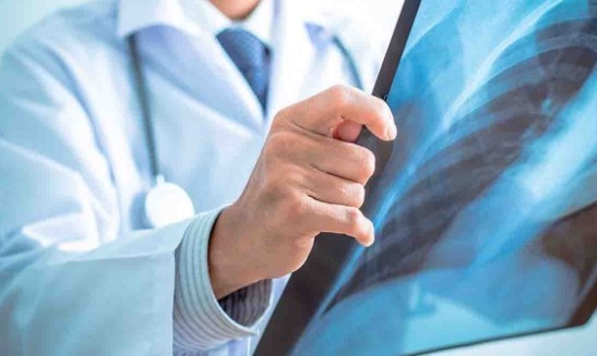 especialidad en neumología especialidad en neumología